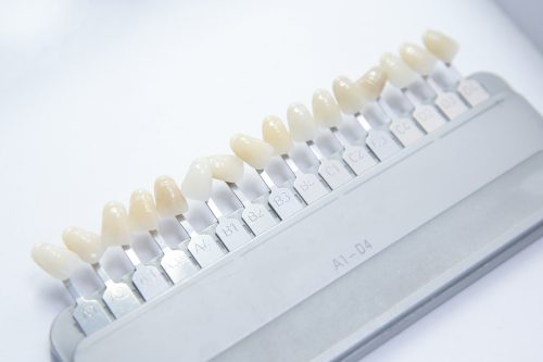 Does Your Cosmetic Dentist Have “Veneerial Disease”?